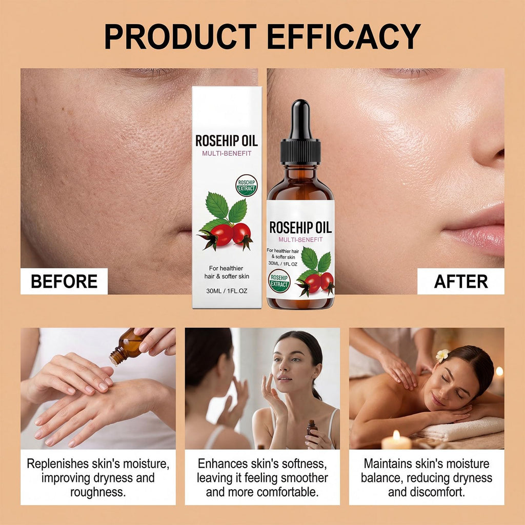 Rosehip Oil Organic Face Oil 1PC U94983