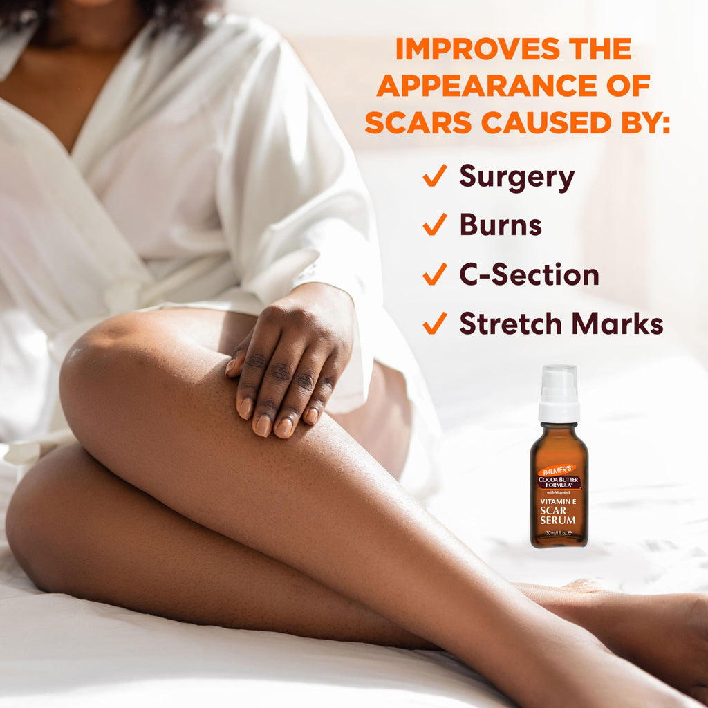 Fragrance Free Cocoa Butter Scar Serum with Vitamin E 1 Oz R526